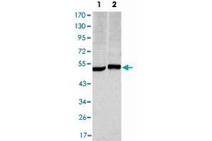 Western blot analysis using CA9 monoclonal antibody, clone 2D3  against HeLa (1) and A-549 (2) cell lysate. (CA9 Antikörper)