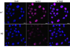 Immunocytochemical staining of HT- cells using MBD2 antibody (ABIN7799387), 1:1,000), Top panel: wild-type (WT), Bottom panal: MBD2 shRNA knockdown (KD). (Rekombinanter MBD2 Antikörper)