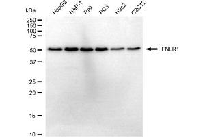 Western blotting analysis using IFNLR1 antibody (ABIN7799105).