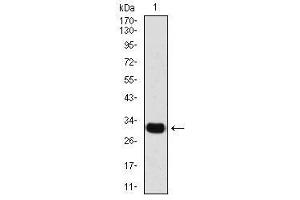 Western Blotting (WB) image for anti-Snail Family Zinc Finger 2 (SNAI2) (AA 100-200) antibody (ABIN5542256)