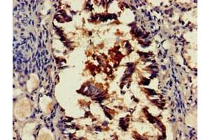 Immunohistochemistry of paraffin-embedded human lung tissue using ABIN7168699 at dilution of 1:100 (SCTR Antikörper  (AA 51-135))