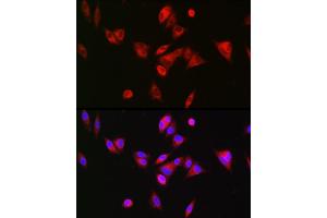 Immunofluorescence analysis of Hep G2 cells using BAAT Rabbit pAb (ABIN6131367, ABIN6137411, ABIN6137412 and ABIN6223563) at dilution of 1:200 (40x lens). (BAAT Antikörper  (AA 309-418))