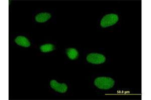 Immunofluorescence of purified MaxPab antibody to RPP40 on HeLa cell. (RPP40 Antikörper  (AA 1-244))