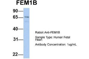 Host: Rabbit  Target Name: FEM1B  Sample Tissue: Human Fetal Heart  Antibody Dilution: 1. (FEM1B Antikörper  (C-Term))