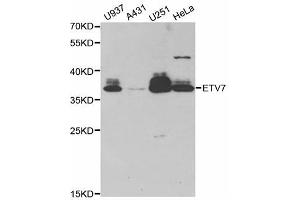 Western blot analysis of extracts of various cell lines, using ETV7 antibody (ABIN5973686) at 1/1000 dilution. (ETV7 Antikörper)