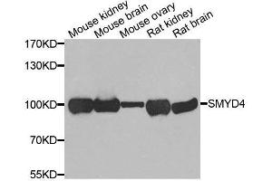 Western blot analysis of extracts of various cell lines, using SMYD4 antibody. (SMYD4 Antikörper  (AA 1-260))