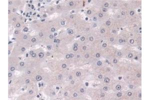 Detection of PLD in Human Liver Tissue using Polyclonal Antibody to Phospholipase D (PLD) (Phospholipase D Antikörper  (AA 725-1074))