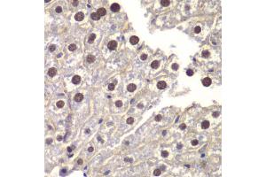 Immunohistochemistry of paraffin-embedded mouse liver using ST14 antibody (ABIN6293606) at dilution of 1:200 (40x lens).