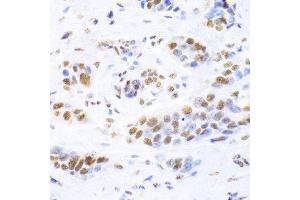 Immunohistochemistry (Paraffin-embedded Sections) (IHC (p)) image for anti-X-Ray Repair Complementing Defective Repair in Chinese Hamster Cells 5 (Double-Strand-Break Rejoining) (XRCC5) (AA 543-732) antibody (ABIN6150309)