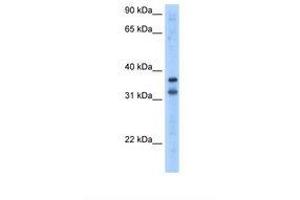 Image no. 1 for anti-Tripartite Motif Containing 13 (TRIM13) (AA 51-100) antibody (ABIN324386) (TRIM13 Antikörper  (AA 51-100))