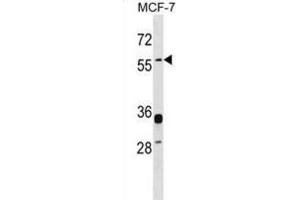 Western Blotting (WB) image for anti-Endogenous Retrovirus Group W, Member 1 (ERVW-1) antibody (ABIN2999163) (ERVW-1 Antikörper)