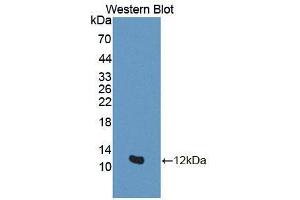 Western blot analysis of the recombinant protein. (GTF2H5 Antikörper  (AA 1-71))