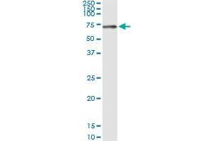 STK33 (Human) IP-WB Antibody Pair