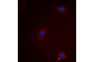 Immunofluorescent analysis of Ataxin 1 (pS775) staining in HEK293 cells. (Ataxin 1 Antikörper  (C-Term, pSer775))