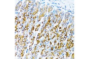 Immunohistochemistry of paraffin-embedded mouse stomach using C antibody (ABIN3021053, ABIN3021054, ABIN3021055 and ABIN6213930) at dilution of 1:100 (40x lens). (ACVR1C/ALK7 Antikörper  (AA 22-113))
