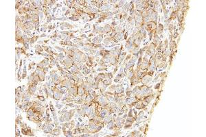 IHC-P Image Immunohistochemical analysis of paraffin-embedded A549 xenograft, using LIMCH1, antibody at 1:500 dilution. (LIMCH1 Antikörper  (C-Term))