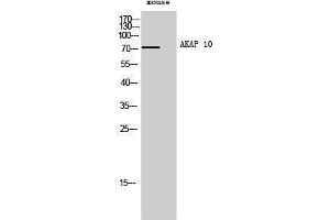 Western Blotting (WB) image for anti-A Kinase (PRKA) Anchor Protein 10 (AKAP10) (N-Term) antibody (ABIN3173722) (AKAP10 Antikörper  (N-Term))
