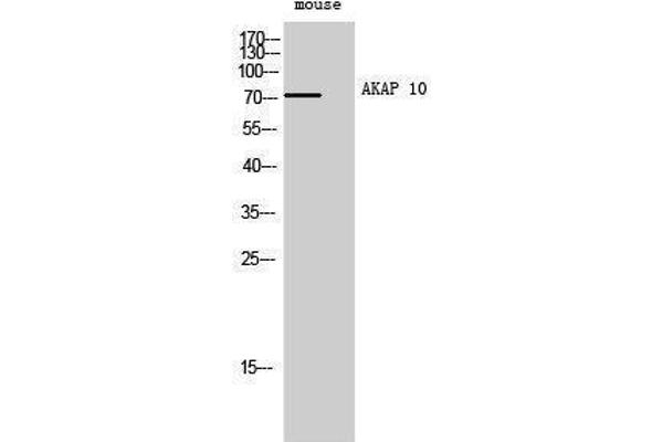 AKAP10 Antikörper  (N-Term)