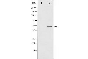 Western blot analysis of BLNK expression in etoposide treated 293 whole cell lysates,The lane on the left is treated with the antigen-specific peptide. (B-Cell Linker Antikörper  (N-Term))
