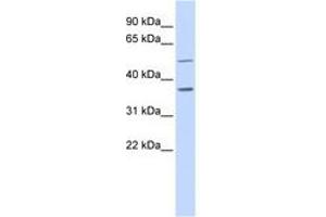Image no. 1 for anti-Prostaglandin Reductase 2 (PTGR2) (AA 108-157) antibody (ABIN6741206) (PTGR2 Antikörper  (AA 108-157))