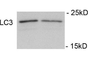 Immunoblots of SH-SY5Y cells treated with rapamycin for 1 h was probed with (ABIN389699 and ABIN2839660). (LC3C Antikörper  (pSer12))