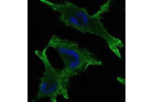 Immunofluorescence analysis of U251 cells using JUP mouse mAb (green).