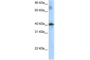 WB Suggested Anti-Tsc22d4 Antibody Titration:  5.