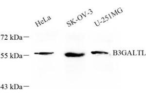 Western blot analysis of B3GALTL (ABIN7073206) at dilution of 1: 600 (B3GALTL Antikörper)