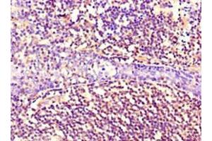 Immunohistochemistry of paraffin-embedded human tonsil tissue using ABIN7161178 at dilution of 1:100 (Nestin Antikörper)