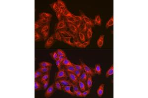 Immunofluorescence analysis of U-2 OS cells using β-Tubulin Rabbit pAb (ABIN3020552, ABIN3020553 and ABIN3020554) at dilution of 1:100 (40x lens). (TUBB Antikörper  (AA 40-260))