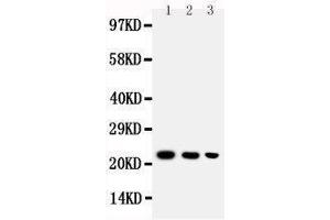 Anti-BAFF antibody, Western blotting Lane 1: Recombinant Human BAFF Protein 10ng Lane 2: Recombinant Human BAFF Protein 5ng Lane 3: Recombinant Human BAFF Protein 2.