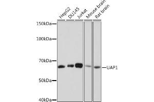 Western blot analysis of extracts of various cell lines, using U Rabbit mAb (ABIN7271211) at 1:1000 dilution. (UAP1 Antikörper)