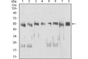 Western Blotting (WB) image for anti-DEAD (Asp-Glu-Ala-Asp) Box Polypeptide 39B (DDX39B) (AA 1-250) antibody (ABIN5926983) (DDX39B Antikörper  (AA 1-250))