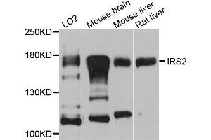 Western blot analysis of extracts of various cells, using IRS2 antibody.