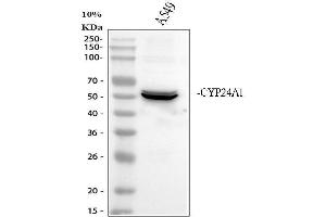 Western blot analysis of CYP24A1 using anti-CYP24A1 antibody (ABIN3042784).