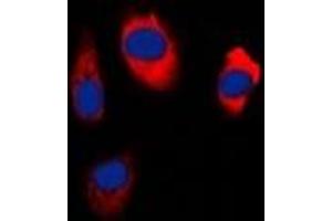Immunofluorescent analysis of EDG5 staining in Hela cells. (S1PR2 Antikörper  (C-Term))
