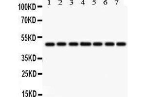 Western Blotting (WB) image for anti-Isocitrate Dehydrogenase 1 (NADP+), Soluble (IDH1) (AA 381-413), (C-Term) antibody (ABIN3043855) (IDH1 Antikörper  (C-Term))