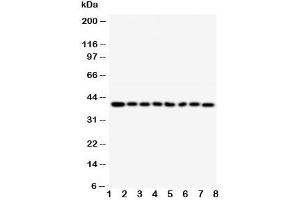 Western blot testing of PPID antibody and Lane 1:  rat brain (PPID Antikörper  (AA 351-370))