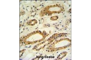 DDO Antibody (Center) (ABIN650991 and ABIN2840026) IHC analysis in formalin fixed and paraffin embedded lung tissue followed by peroxidase conjugation of the secondary antibody and DAB staining. (DDO Antikörper  (AA 102-130))