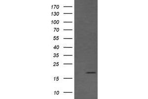Image no. 1 for anti-Cancer/testis Antigen 1B (CTAG1B) antibody (ABIN1499907) (CTAG1B Antikörper)