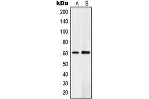 Western blot analysis of PLK5 expression in Jurkat (A), human brain (B) whole cell lysates. (PLK5 Antikörper  (Center))