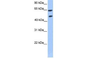 Transfected 293T; WB Suggested Anti-ZNF449 Antibody Titration: 0. (ZNF449 Antikörper  (Middle Region))