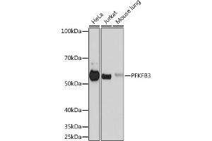 Western blot analysis of extracts of various cell lines, using PFKFB3 Rabbit mAb (ABIN1680620, ABIN3018306, ABIN3018307 and ABIN7101590) at 1:500 dilution. (PFKFB3 Antikörper)