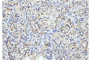 IHC analysis of ITCH/AIP4 using anti-ITCH/AIP4 antibody (ABIN7600263). (ITCH Antikörper  (AA 17-358))