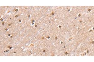 Immunohistochemistry of paraffin-embedded Human brain using SMARCB1 Polyclonal Antibody at dilution of 1:30 (SMARCB1 Antikörper)