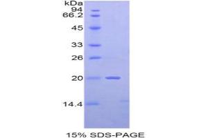 SDS-PAGE analysis of Mouse NME2 Protein.