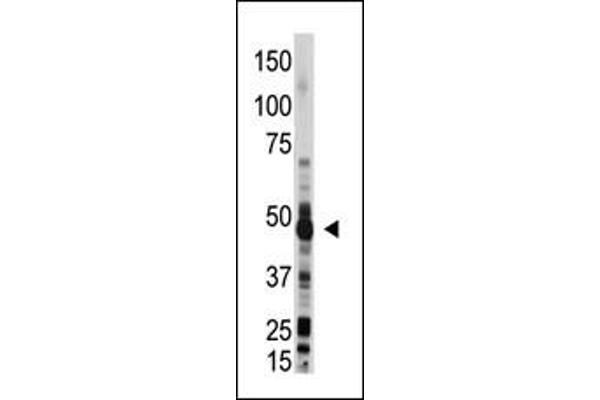 OAS1 Antikörper  (C-Term)