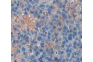 IHC-P analysis of Human Tissue, with DAB staining. (QPCT Antikörper  (AA 29-361))