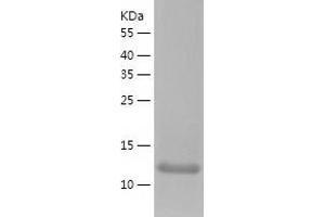 Dysbindin (Dystrobrevin Binding Protein 1) Domain Containing 1 (DBNDD1) (AA 1-158) protein (His tag)