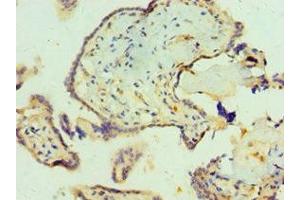 Immunohistochemistry of paraffin-embedded human placenta tissue using ABIN7161703 at dilution of 1:100 (SCP2 Antikörper  (AA 1-322))